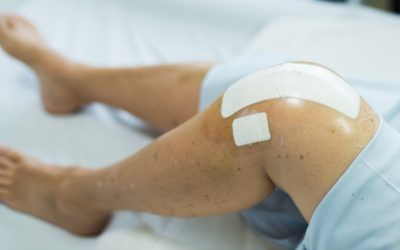 What You May Expect after a Joint Replacement Surgery