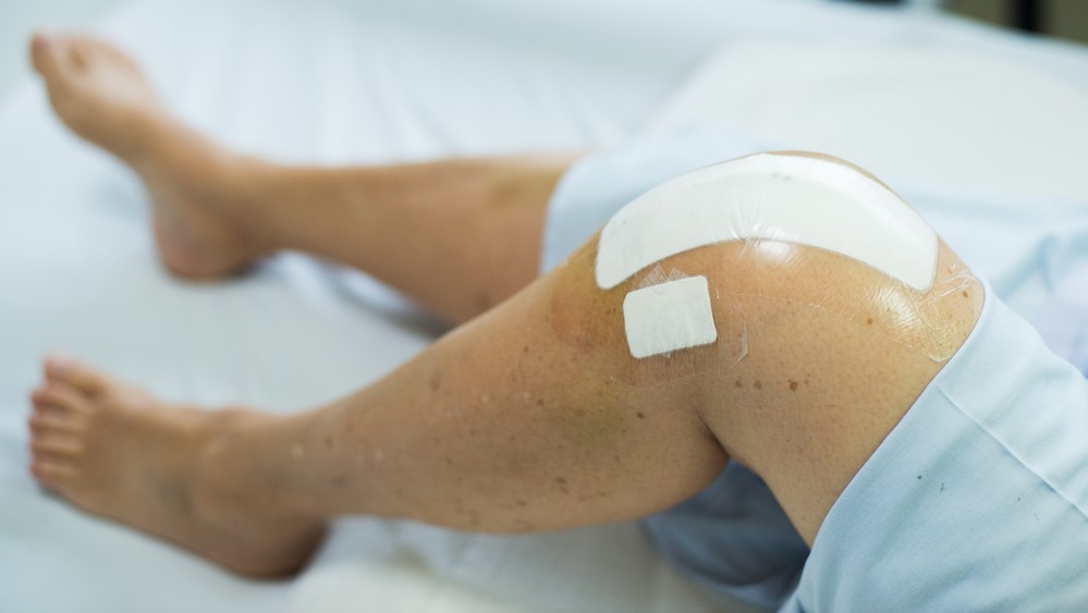 What You May Expect after a Joint Replacement Surgery