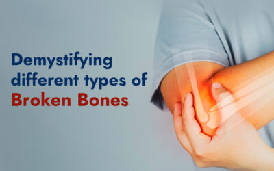 Demystifying different types of Broken Bones