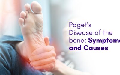 Paget’s Disease of the bone: Symptoms and Causes