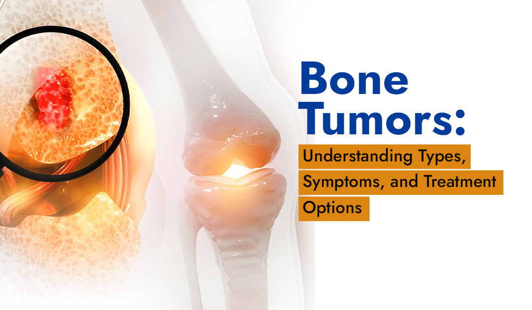 Bone Tumors