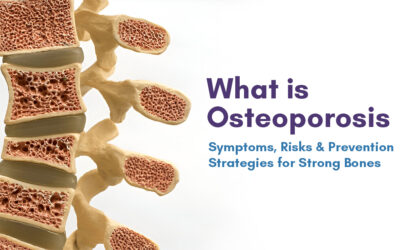 What is Osteoporosis: Symptoms, Risks & Prevention Strategies for Strong Bones