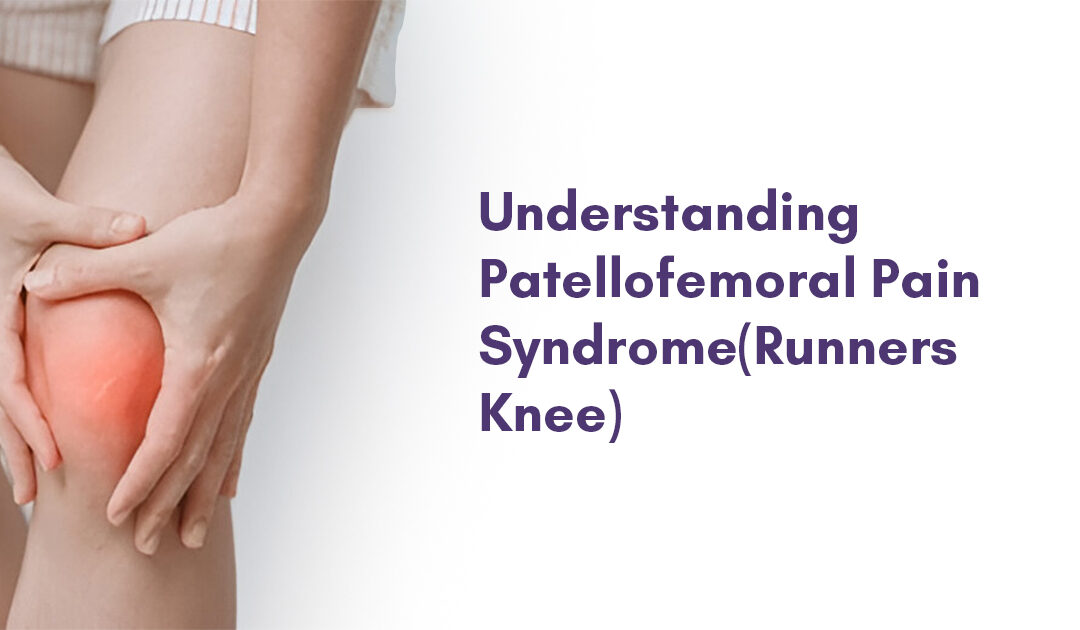 Patellofemoral Pain Syndrome