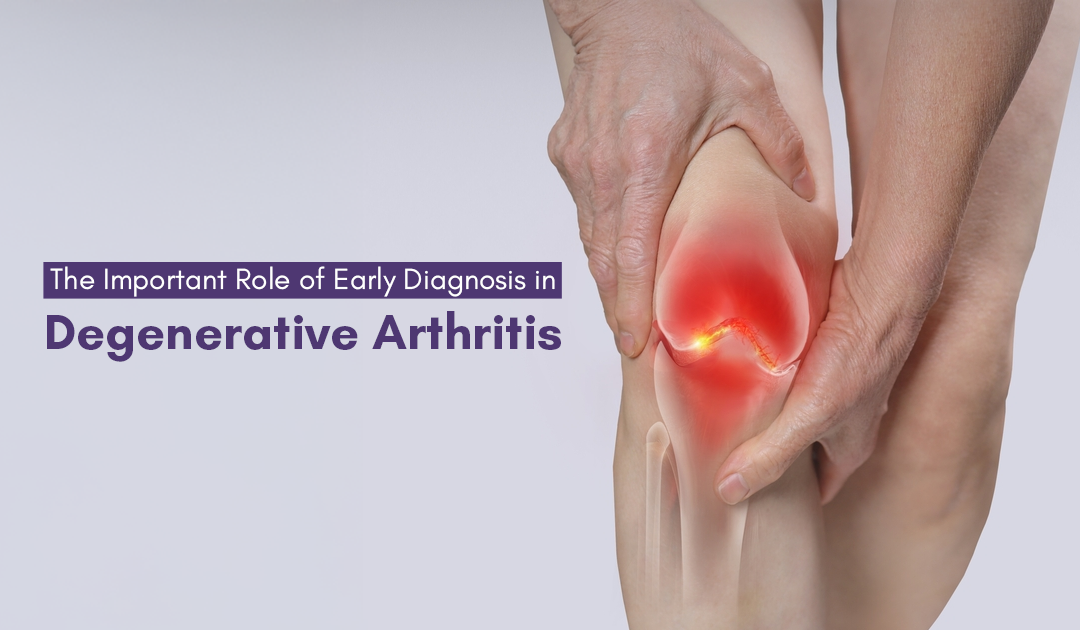 Arthritis