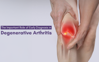 The Important Role of Early Diagnosis in Degenerative Arthritis