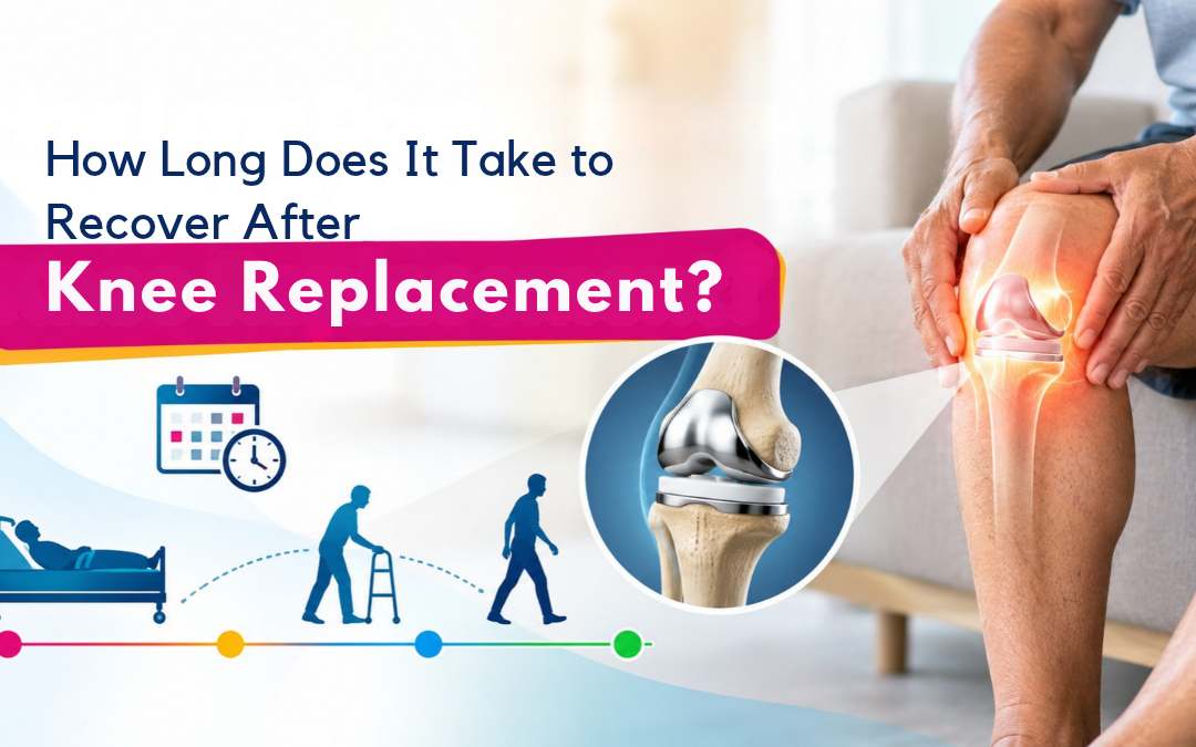 How Long Does It Take to Recover After Knee Replacement?