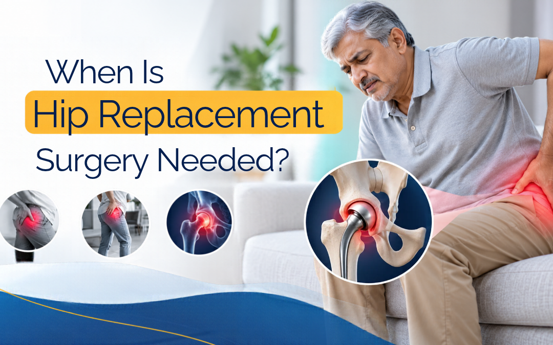 When Is Hip Replacement Surgery Needed?